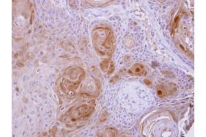 IHC-P Image BBOX1 antibody detects BBOX1 protein at cytosol on Ca922 xenograft by immunohistochemical analysis. (BBOX1 抗体  (Center))