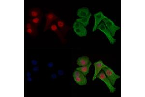 ABIN6256486 and ABIN6274031 staining Hela cells(heat shock treatment) by IF/ICC. (HIST1H1E 抗体  (pThr18))