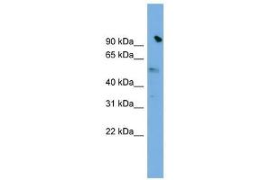SLC25A25 antibody used at 1 ug/ml to detect target protein. (SLC25A25 抗体)