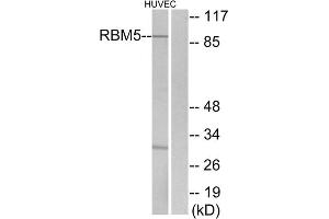 Western blot analysis of extracts from HUVEC cells, using RBM5 antibody. (RBM5 抗体  (Internal Region))