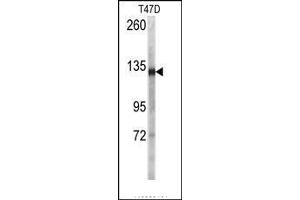 Image no. 1 for anti-Desmoglein 2 (DSG2) (N-Term) antibody (ABIN360106) (Desmoglein 2 抗体  (N-Term))