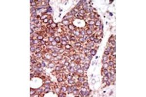 Image no. 2 for anti-Glucosaminyl (N-Acetyl) Transferase 1, Core 2 (GCNT1) (C-Term) antibody (ABIN357692) (GCNT1 抗体  (C-Term))