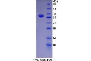 Image no. 1 for Hes Family bHLH Transcription Factor 1 (HES1) (AA 21-251) protein (His tag) (ABIN4990887) (HES1 Protein (AA 21-251) (His tag))