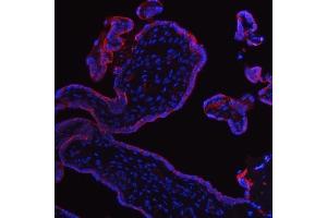 IF analysis of ALPP using anti-ALPP antibody (ABIN4886453).