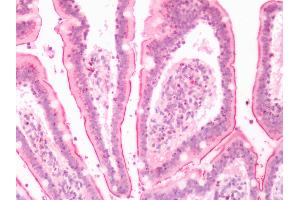 Human Small Intestine: Formalin-Fixed, Paraffin-Embedded (FFPE) (LTB4R2 抗体  (N-Term))
