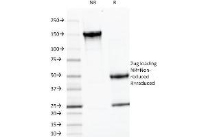 SDS-PAGE Analysis Purified LH-beta Mouse Monoclonal Antibody (LHb/1214). (LHB 抗体)
