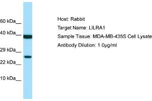Host: Rabbit Target Name: LILRA1 Sample Type: MDA-MB-435S Whole Cell lysates Antibody Dilution: 1.