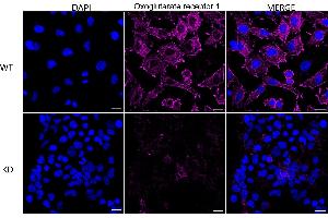 Immunocytochemical staining of HeLa cells using Oxoglutarate receptor 1 antibody (ABIN7799714), 1:1,000), Top panel: wild-type (WT), Bottom panal: Oxoglutarate receptor 1 shRNA knockdown (KD). (Recombinant OXGR1 抗体)