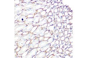 Immunohistochemistry of paraffin-embedded mouse kidney using Filamin A Rabbit mAb (ABIN1682545, ABIN3018024, ABIN3018025 and ABIN7101570) at dilution of 1:100 (40x lens). (Filamin A 抗体)