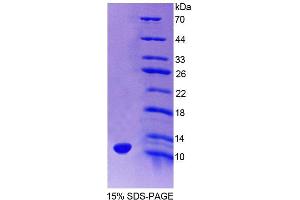 SDS-PAGE (SDS) image for HOP Homeobox (HOPX) (AA 11-73) protein (His tag) (ABIN6238691)