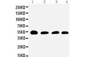 Anti-Antithrombin III antibody, Western blotting Lane 1: Rat Testis Tissue Lysate Lane 2: SMMC Cell Lysate Lane 3: JURKAT Cell Lysate Lane 4: RAJI Cell Lysate (SERPINC1 抗体  (N-Term))
