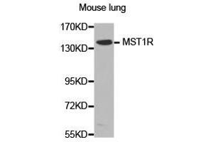 Western Blotting (WB) image for anti-Macrophage Stimulating 1 Receptor (C-Met-Related tyrosine Kinase) (MST1R) antibody (ABIN2650934) (MST1R 抗体)