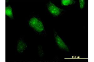 Immunofluorescence of monoclonal antibody to BATF2 on HeLa cell. (BATF2 抗体  (AA 1-189))