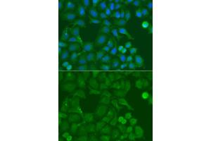 Immunofluorescence analysis of A549 cell using SSX5 antibody. (SSX5 抗体)