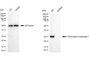 Western blotting analysis using pancreatic proteinase 1 antibody (ABIN7799732).