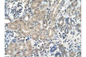 Image no. 1 for anti-Ribosomal RNA Processing 1 Homolog A (RRP1) (AA 344-393) antibody (ABIN6738188) (RRP1 抗体  (AA 344-393))