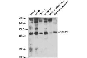 Western blot analysis of extracts of various cell lines, using VENTX antibody  at 1:1000 dilution. (VENTX 抗体  (AA 1-258))