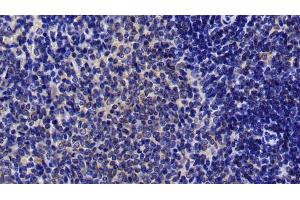 Detection of MAP2K4 in Rat Spleen Tissue using Polyclonal Antibody to Mitogen Activated Protein Kinase Kinase 4 (MAP2K4) (MAP2K4 抗体  (AA 137-394))