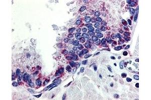 Immunohistochemistry (IHC) image for anti-Tumor Necrosis Factor (Ligand) Superfamily, Member 13 (TNFSF13) (2nd Extracellular Domain) antibody (ABIN1030837)