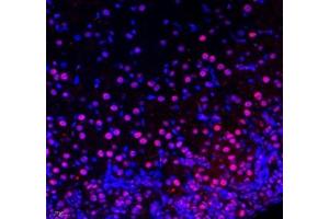 Immunohistochemistry (Paraffin-embedded Sections) (IHC (p)) image for anti-Endosome/Lysosome-associated Apoptosis and Autophagy Regulator 1 (ELAPOR1) antibody (ABIN7073822)