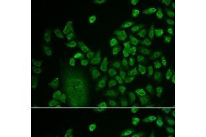 Immunofluorescence analysis of HeLa cells using LSM4 Polyclonal Antibody at dilution of 1:50. (LSM4 抗体)