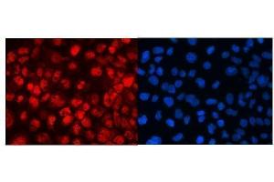 IF analysis of MED18 using anti-MED18 antibody (ABIN5519036).