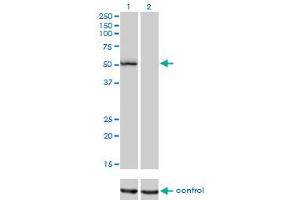 Western blot analysis of BFAR over-expressed 293 cell line, cotransfected with BFAR Validated Chimera RNAi (Lane 2) or non-transfected control (Lane 1). (BFAR 抗体  (AA 101-200))