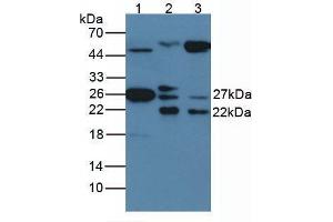Western blot analysis of (1) Rat Serum Tissue, and (2) Rat Spleen Tissue, using Rabbit Anti-Human HSP27 Antibody (1 µg/ml) and HRP-conjugated Rabbit Anti-Mouse antibody ( (HSP27 抗体  (AA 2-205))