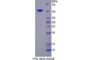 SDS-PAGE (SDS) image for P450 (Cytochrome) Oxidoreductase (POR) (AA 210-578) protein (His tag) (ABIN1878747)