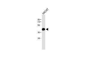 Anti-RCO Antibody (N-term) at 1:500 dilution + HACAT whole cell lysate Lysates/proteins at 20 μg per lane. (MARCO 抗体  (AA 13-40))