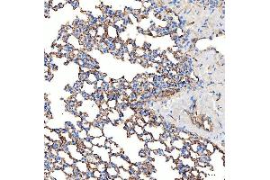 IHC analysis of SLC9A3R2 using anti-SLC9A3R2 antibody (ABIN7599271).