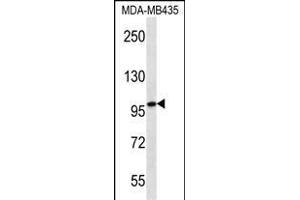 MYO1C ABIN659126 western blot analysis in MDA-M cell line lysates (35 μg/lane). (Myosin IC 抗体)