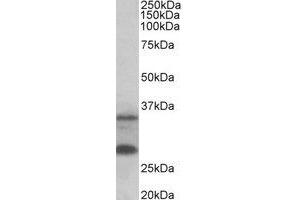 Western Blotting (WB) image for anti-U6 SnRNA Biogenesis 1 (USB1) (Internal Region) antibody (ABIN2465002) (C16orf57 抗体  (Internal Region))