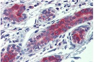 Human Breast: Formalin-Fixed, Paraffin-Embedded (FFPE) (YES1 抗体  (AA 284-541))