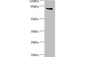 Western blot All lanes: Interleukin enhancer-binding factor 3 antibody at 3 μg/mL + HepG2 whole cell lysate Secondary Goat polyclonal to rabbit IgG at 1/10000 dilution Predicted band size: 96, 77, 83, 76, 75 kDa Observed band size: 96 kDa (Interleukin enhancer-binding factor 3 (ILF3) (AA 785-894) 抗体)