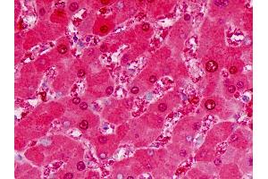 Human Liver: Formalin-Fixed, Paraffin-Embedded (FFPE) (ALDH5A1 抗体  (AA 128-157))