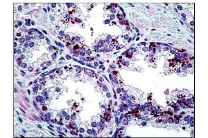 Human Prostate: Formalin-Fixed, Paraffin-Embedded (FFPE) (ARTN 抗体  (Internal Region))