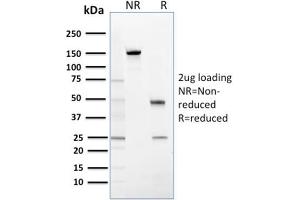 SDS-PAGE (SDS) image for anti-Stratifin (SFN) antibody (ABIN6939540)