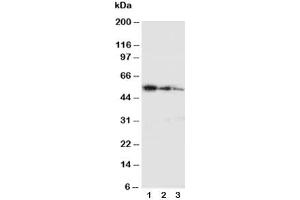 Western blot testing with Ki-67 antibody and partial human recombinant protein