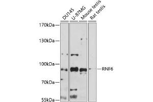 Western blot analysis of extracts of various cell lines, using RNF6 antibody (ABIN7270075) at 1:1000 dilution. (RNF6 抗体  (AA 1-300))