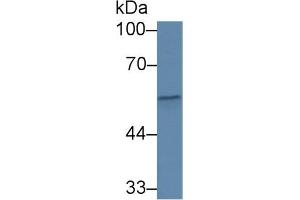 Western Blot; Sample: Human Serum; Primary Ab: 1µg/ml Rabbit Anti-Human CFP Antibody Second Ab: 0. (CFP 抗体  (AA 65-190))