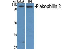 Western Blot (WB) analysis of Jurkat and 293 cells using Plakophilin 2 Polyclonal Antibody. (Plakophilin 2 抗体  (C-Term))