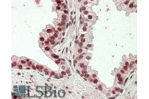 ABIN570834 (3. (Homeobox D13 抗体  (Internal Region))