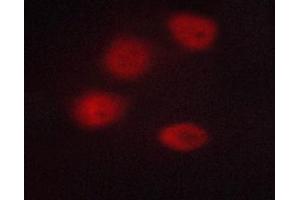 ABIN6267233 staining A549 cells by ICC/IF. (HDAC3 抗体  (pSer424))
