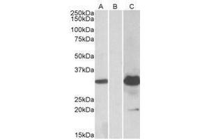 HEK293 lysate (10 µg protein in RIPA buffer) overexpressing Human KCTD11 with DYKDDDDK tag probed with AP23752PU-N (1. (KCTD11 抗体  (Internal Region))