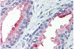Human Prostate (formalin-fixed, paraffin-embedded) stained with FOLH1 antibody ABIN364300 at 10 ug/ml followed by biotinylated anti-mouse IgG secondary antibody ABIN481714, alkaline phosphatase-streptavidin and chromogen. (PSMA 抗体)