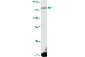 LRRK1 MaxPab rabbit polyclonal antibody. (LRRK1 抗体  (AA 1-261))