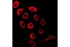 Immunofluorescent analysis of PDE1B staining in MCF7 cells. (PDE1B 抗体)