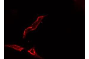 ABIN6276650 staining  Hela cells by IF/ICC. (TYR 抗体  (C-Term))