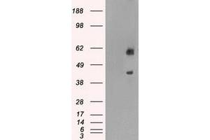 HEK293T cells were transfected with the pCMV6-ENTRY control (Left lane) or pCMV6-ENTRY PPP1R7 (Right lane) cDNA for 48 hrs and lysed. (PPP1R7 抗体)